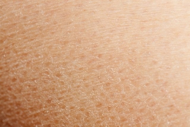 ¡11 causas de la resequedad en la piel!: Descubre qué hacer para combatirla