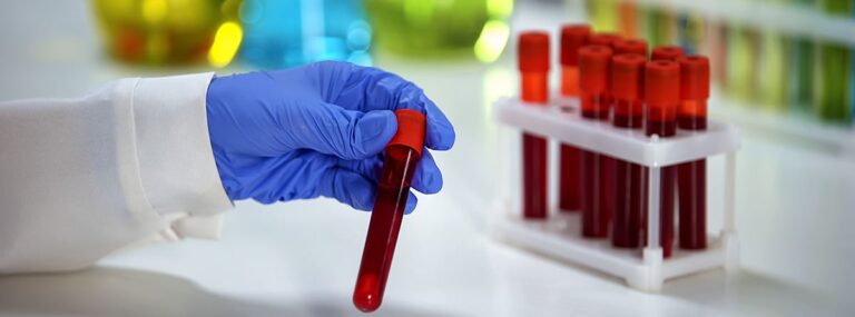 CHCM: las claves de un misterio sanguíneo