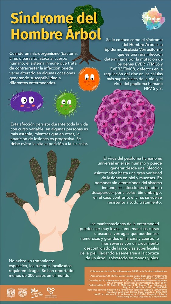 Epidermodisplasia Verruciforme: una enfermedad de verrugas y lesiones en la piel