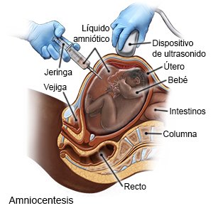 Eritroblastose fetal: todo lo que debes saber