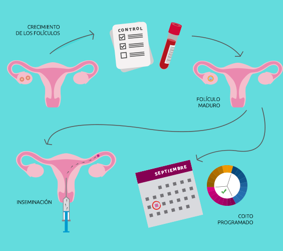 Inducción de ovulación: conceptos nuevos y alternativas naturales