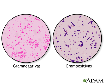 La Coloración de Gram: Una técnica que revela los secretos de las bacterias