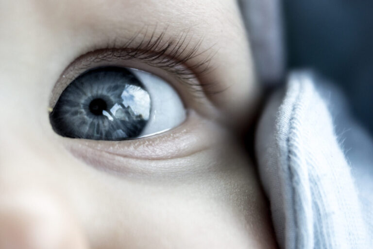 La verdad sobre el glaucoma congénito: todo lo que necesitas saber