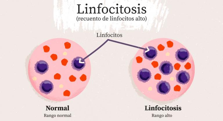 Niveles de linfocitos: desentrañando sus misterios