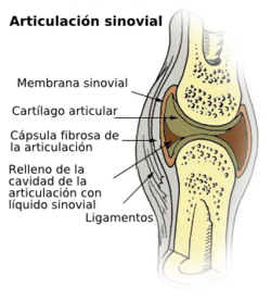 Sinovitis: inflamación de las articulaciones