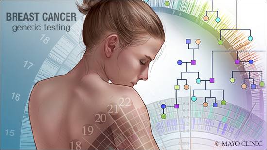 Test genético: desvelando el misterio del cáncer de mama