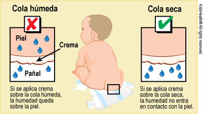 Tratamiento y prevención de la dermatitis del pañal en bebés