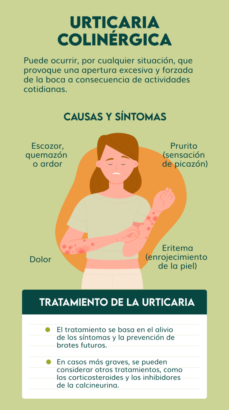 Urticaría colinérgica: síntomas, causas y tratamientos